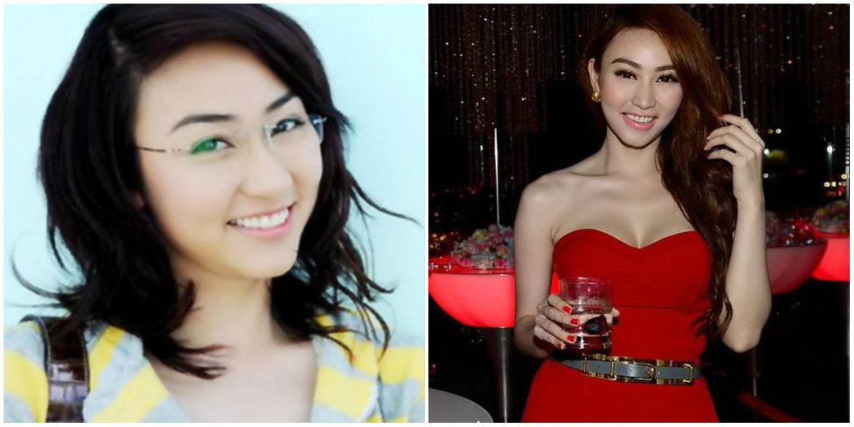 Sao Việt hóa “thiên nga” nhờ dao kéo