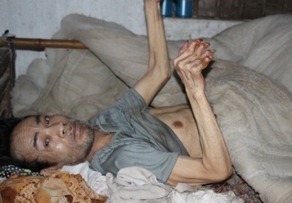 Chồng liệt giường, vợ con mắc bệnh tâm thần Chồng liệt giường, vợ con mắc bệnh tâm thần