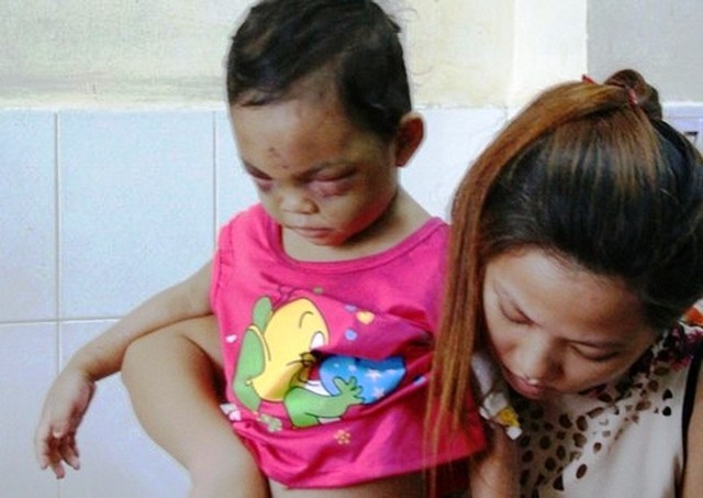 Bé gái 4 tuổi bị đánh dã man: Ruột thịt lại ấm nồng, kẻ nhẫn tâm 