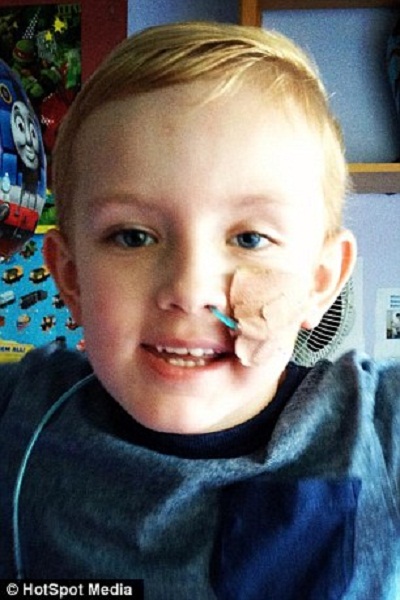 Hình ảnh đau lòng của em bé bị dị ứng thuốc Hình ảnh đau lòng của em bé bị dị ứng thuốc