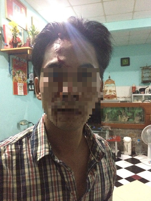 Bình Dương: Bảo vệ dân phố đánh toác đầu dân