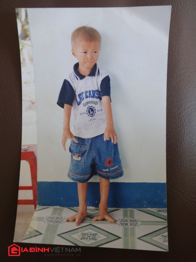 Cuộc sống mong manh của người phụ nữ mang khối u trên ngực