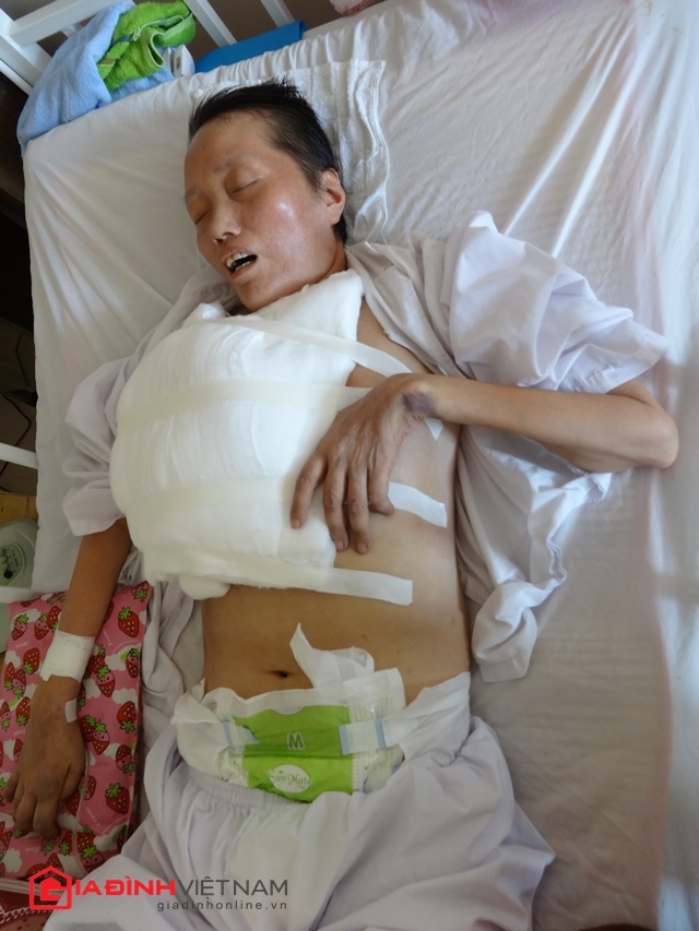 Cuộc sống mong manh của người phụ nữ mang khối u trên ngực