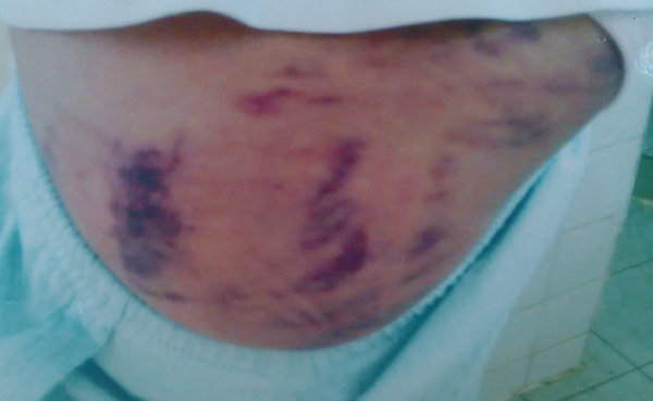 Thiếu nữ 18 tuổi bị cha mẹ nhốt, đánh vì... yêu thầy Thiếu nữ 18 tuổi bị cha mẹ nhốt, đánh vì... yêu thầy