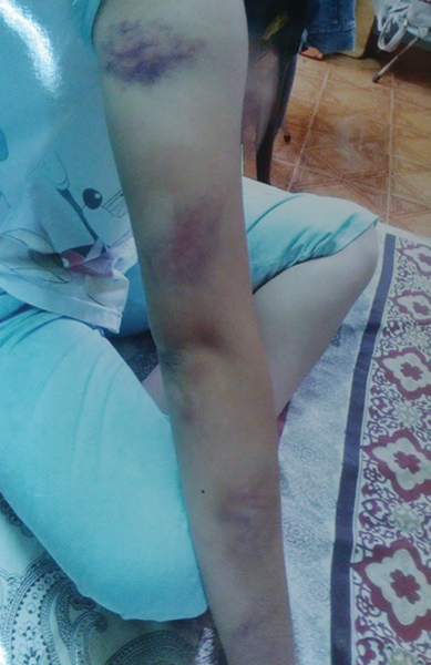 Thiếu nữ 18 tuổi bị cha mẹ nhốt, đánh vì... yêu thầy Thiếu nữ 18 tuổi bị cha mẹ nhốt, đánh vì... yêu thầy