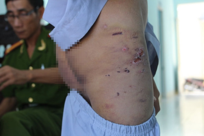 Vụ hai chú tiểu bị hành hạ: Khởi tố người quản chùa