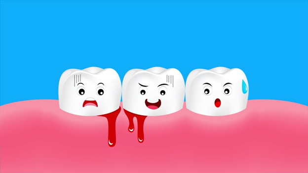 Chảy máu chân răng- Chớ nên coi thường kẻo hối không kịp - Ảnh 1