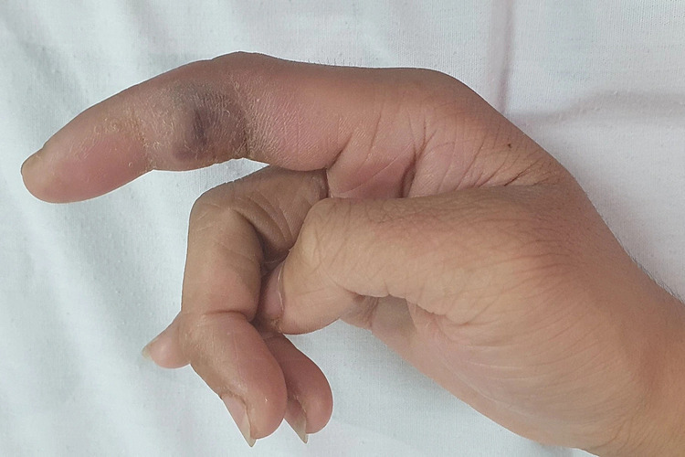 tu nan mun o tay nam thanh nien nhap vien ngay trong dem 1