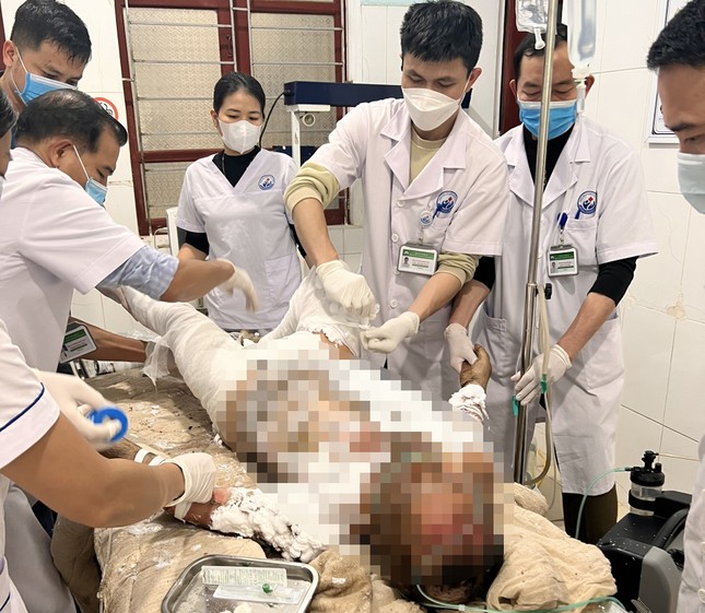 nghi do mau thuan voi vo nguoi chong do xang len nguoi tu thieu 1 nghi do mau thuan voi vo nguoi chong do xang len nguoi tu thieu 1