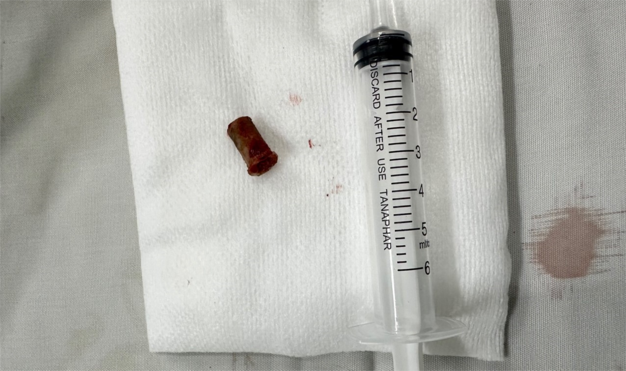 lay chiec coi bi bo quen trong duong tho be trai suot 7 nam 1 lay chiec coi bi bo quen trong duong tho be trai suot 7 nam 1