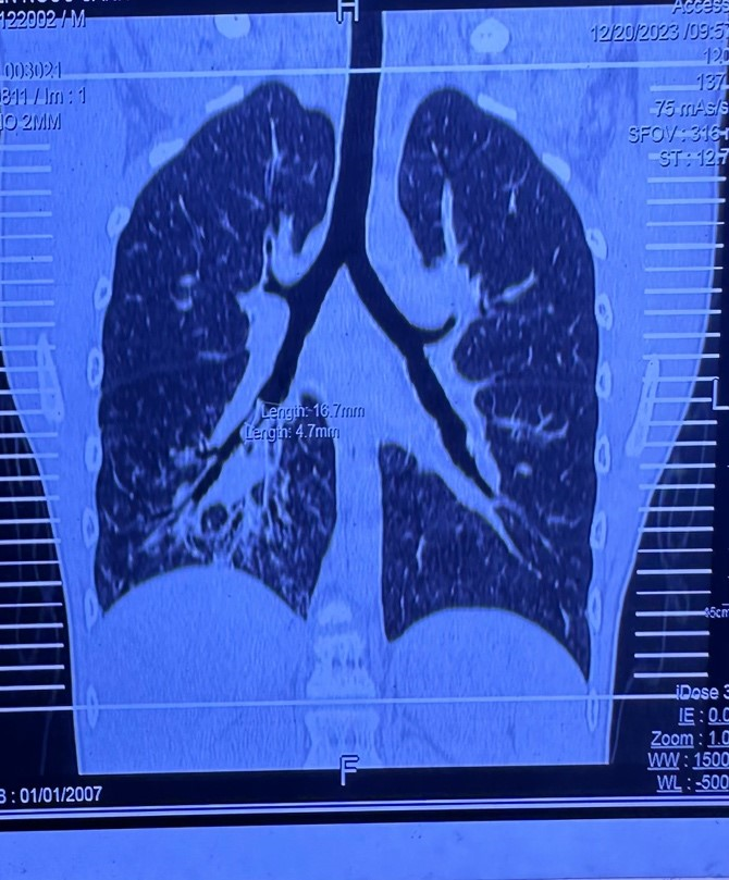 lay chiec coi bi bo quen trong duong tho be trai suot 7 nam 2 lay chiec coi bi bo quen trong duong tho be trai suot 7 nam 2