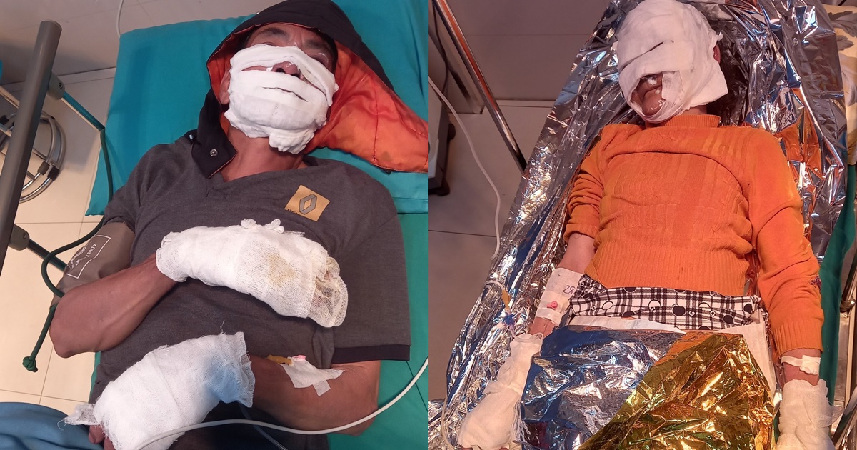 hai benh nhan bi bong nang do thoi quen sac dien thoai qua dem 4 hai benh nhan bi bong nang do thoi quen sac dien thoai qua dem 4