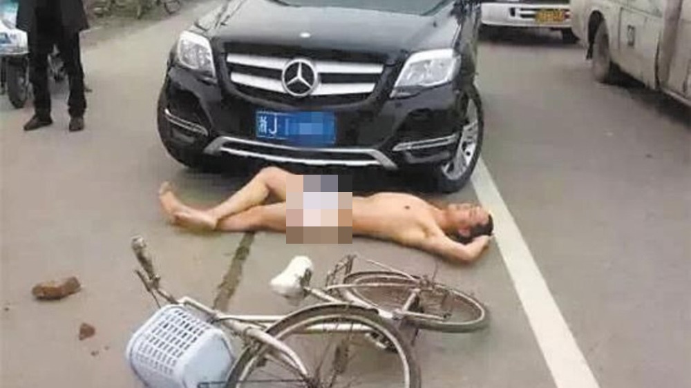 an va khi dung xe nguoi phu nu bong choc bien thanh tro cuoi chi vi hanh dong nay2jpg an va khi dung xe nguoi phu nu bong choc bien thanh tro cuoi chi vi hanh dong nay2jpg
