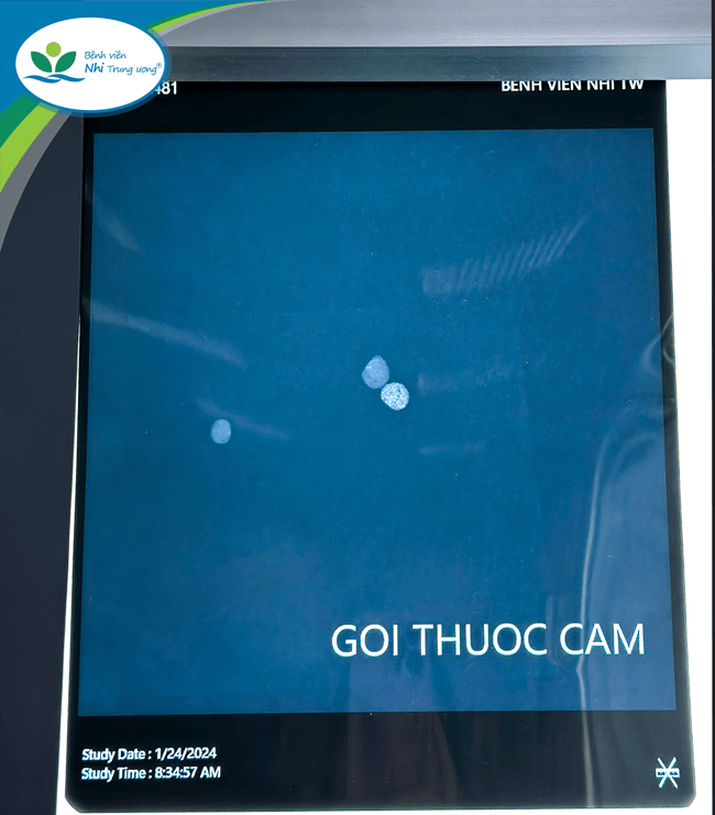 chua benh bang thuoc cam be gai 9 tuoi nguy kich vi ngo doc chi nang bac si canh bao nguy hiem 2 chua benh bang thuoc cam be gai 9 tuoi nguy kich vi ngo doc chi nang bac si canh bao nguy hiem 2