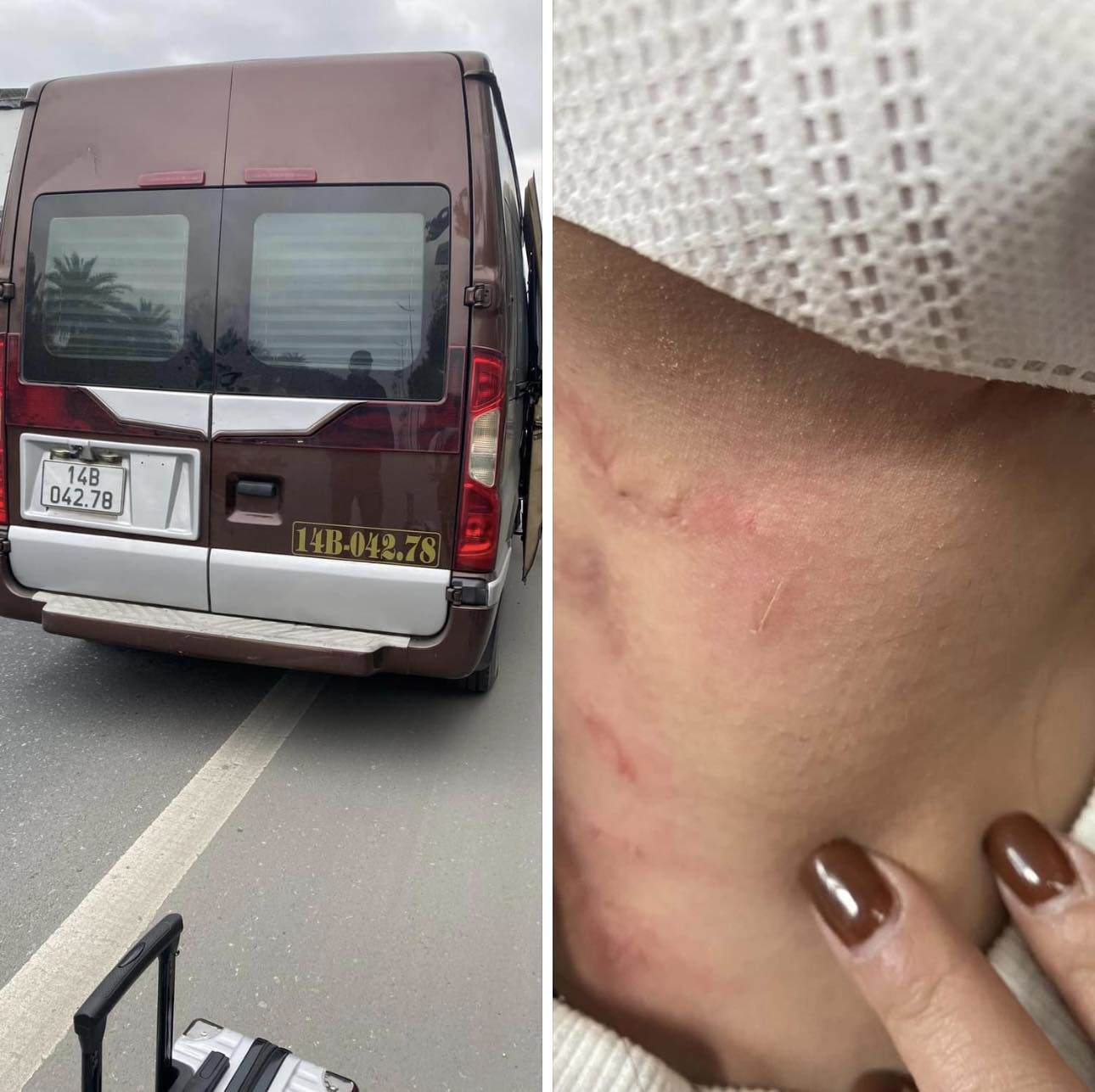 vu nu hanh khach bi nha xe hanh hung bo roi giua cao toc xu phat chu xe limousine 1 vu nu hanh khach bi nha xe hanh hung bo roi giua cao toc xu phat chu xe limousine 1
