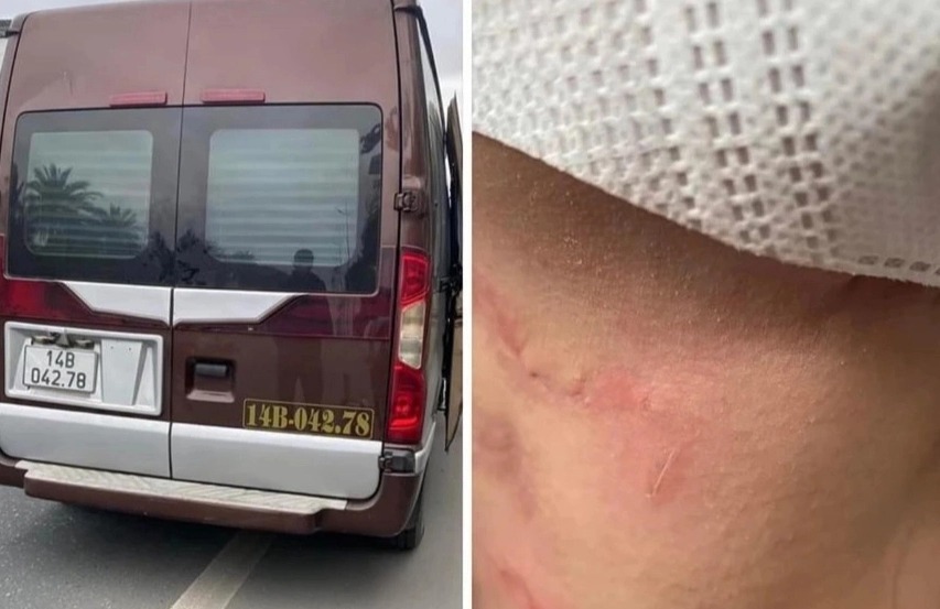 cong an quang ninh dieu tra vu nha xe bi to hanh hung bo roi khach giua cao toc cong an quang ninh dieu tra vu nha xe bi to hanh hung bo roi khach giua cao toc