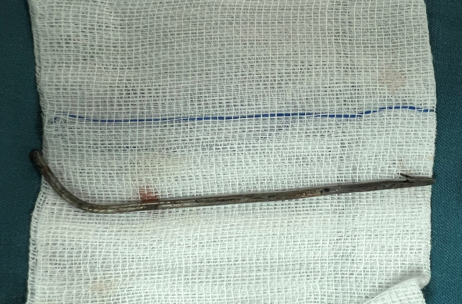 nam thanh nien bi mui ten ban ca dai 7cm dam xuyen tuy nam thanh nien bi mui ten ban ca dai 7cm dam xuyen tuy