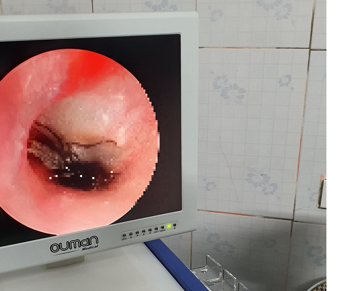 mot con gian duoc phat hien con song trong tai benh nhi 2 thang tuoi mot con gian duoc phat hien con song trong tai benh nhi 2 thang tuoi