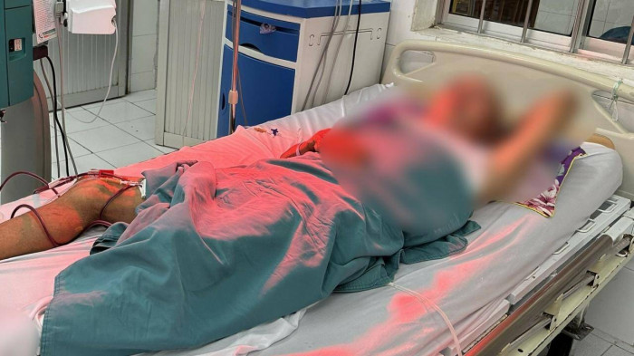 ca mau 5 nguoi nhap vien 1 nguoi tu vong nghi ngo doc ruou tai mot dam tang ca mau 5 nguoi nhap vien 1 nguoi tu vong nghi ngo doc ruou tai mot dam tang