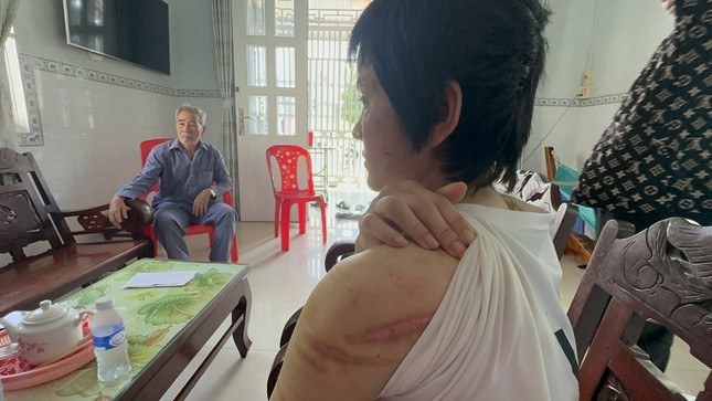 hai duong co qua dieu tra trieu tap nguoi chong bao hanh vo bau 7 thang 23