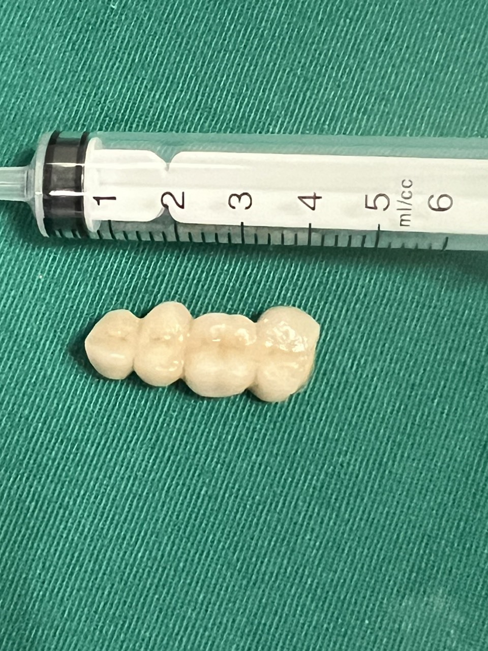 ba do chau bi nga vo tinh nuot phai 4 chiec rang gia1 ba do chau bi nga vo tinh nuot phai 4 chiec rang gia1
