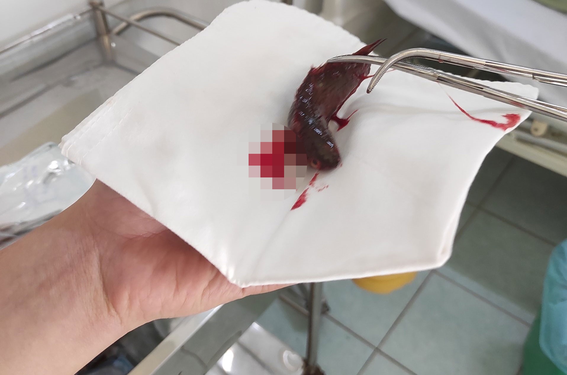 kien giang nguoi dan ong di mo ca vo tinh bi con ca ro nhay vao trong hong 1 kien giang nguoi dan ong di mo ca vo tinh bi con ca ro nhay vao trong hong 1