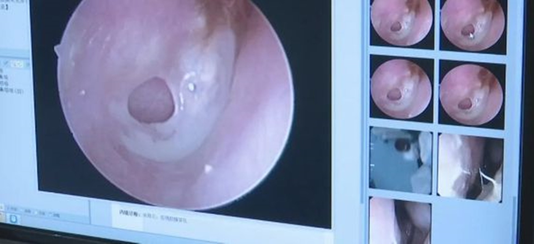 co gai bi ban trai hon cuon nhiet den muc thung mang nhi