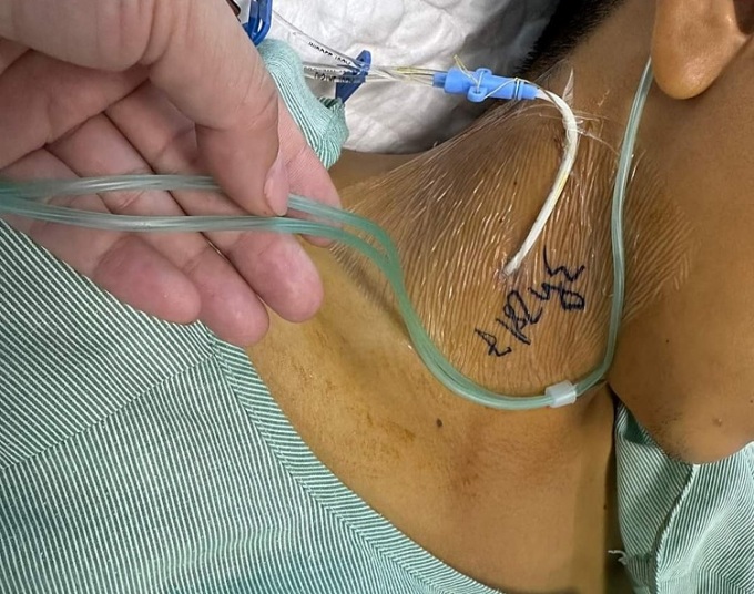 4 nguoi trong 1 gia dinh bi ngo doc sau khi an xoi dung pham mau 1 4 nguoi trong 1 gia dinh bi ngo doc sau khi an xoi dung pham mau 1