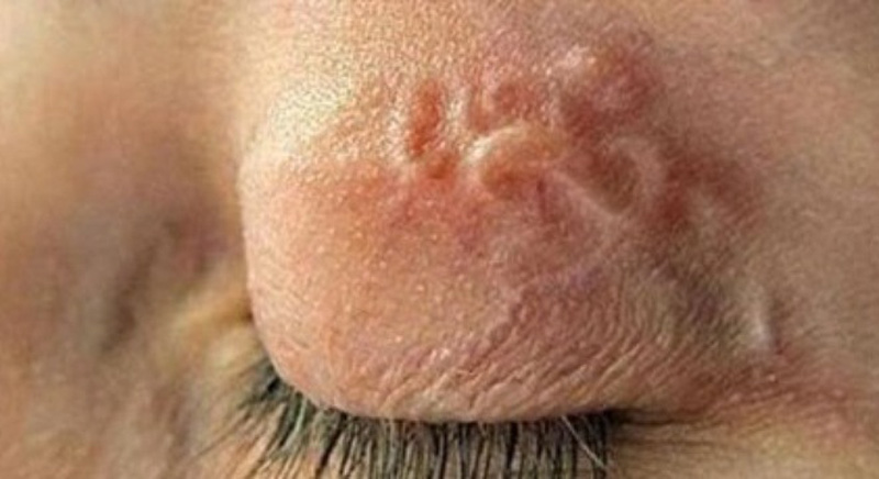 nhiem au trung giun dua vi thoi quen thuong gap o nguoi hay nuoi thu cung2 nhiem au trung giun dua vi thoi quen thuong gap o nguoi hay nuoi thu cung2