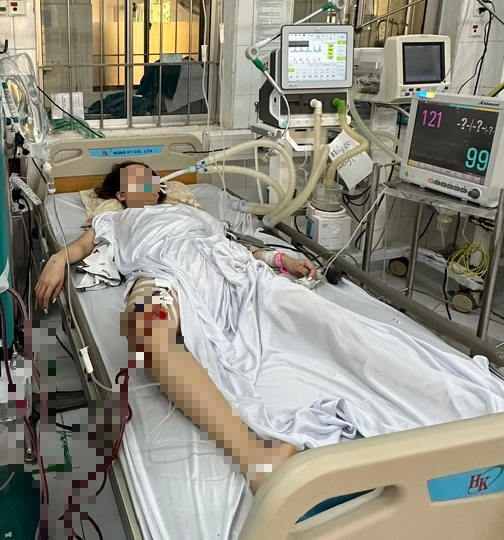2 di chau o ca mau phai nhap vien cap cuu do ngo doc methanol1 2 di chau o ca mau phai nhap vien cap cuu do ngo doc methanol1