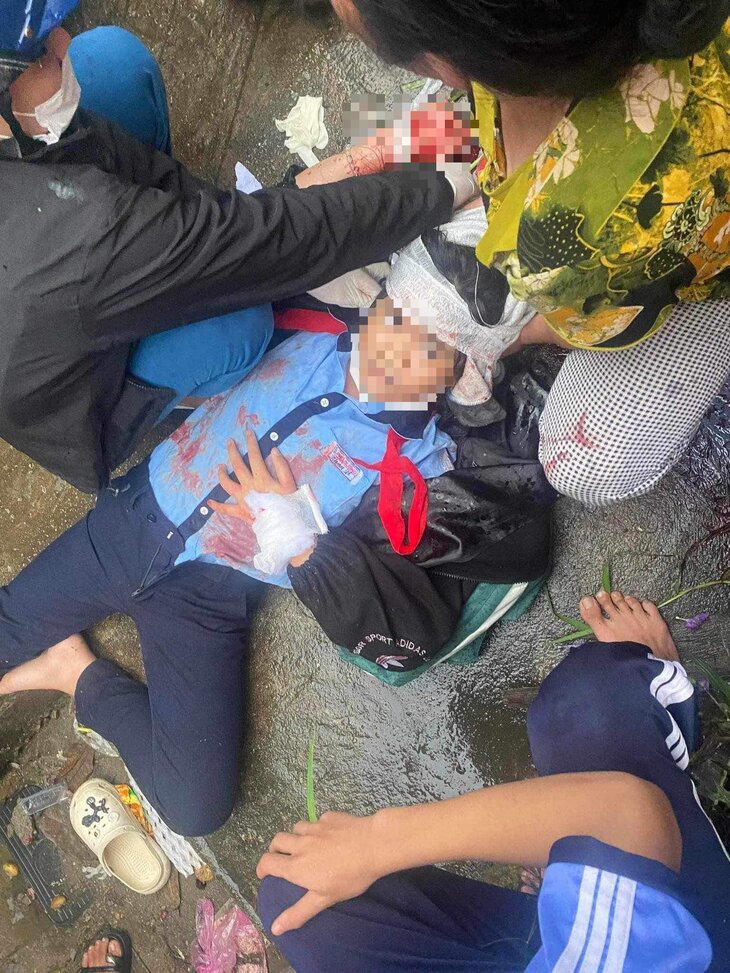 tinh hinh suc khoe cua nu sinh lop 6 bi ga thanh nien dung bua danh vao dau1 tinh hinh suc khoe cua nu sinh lop 6 bi ga thanh nien dung bua danh vao dau1