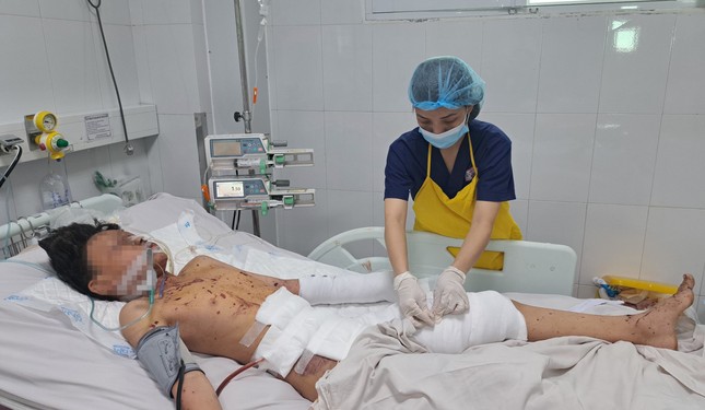 nam sinh 11 tuoi bi thuong nang do choi phao1