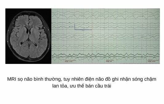 thuong xuyen mat ngu nguoi phu nu roi vao tinh trang la het tu cuoi co giat3 thuong xuyen mat ngu nguoi phu nu roi vao tinh trang la het tu cuoi co giat3