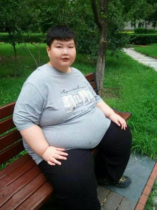 cau be 14 tuoi nang 180kg khoc xin bac si giup giam can gio ra sao 1