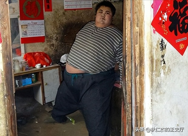 cau be 14 tuoi nang 180kg khoc xin bac si giup giam can gio ra sao 2