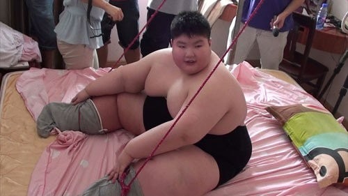 cau be 14 tuoi nang 180kg khoc xin bac si giup giam can gio ra sao 5