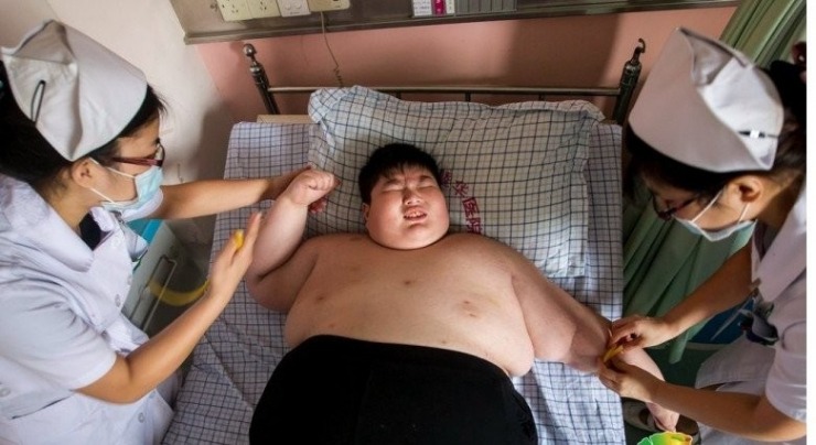 cau be 14 tuoi nang 180kg khoc xin bac si giup giam can gio ra sao 6