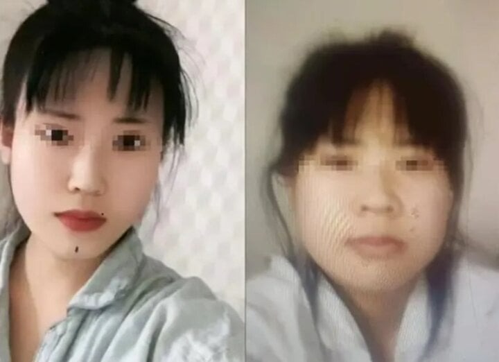 phau thuat tham my that bai co gai quan tri nhay song tu tu tin nhan gui me gay chu y1 phau thuat tham my that bai co gai quan tri nhay song tu tu tin nhan gui me gay chu y1