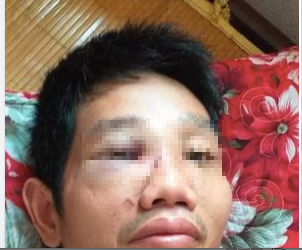 tin tuc phap luat moi nhat ngay 8 6 2021 14 nam thanh nu tu lam dieu mo am trong can ho chung cu dspl 2 tin tuc phap luat moi nhat ngay 8 6 2021 14 nam thanh nu tu lam dieu mo am trong can ho chung cu dspl 2