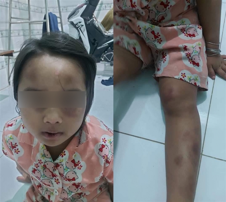 tin tuc phap luat ngay 18 7 ga trai giet nguoi tinh de xac trong phong hon 1 tuan moi dau thu dspl 2 tin tuc phap luat ngay 18 7 ga trai giet nguoi tinh de xac trong phong hon 1 tuan moi dau thu dspl 2