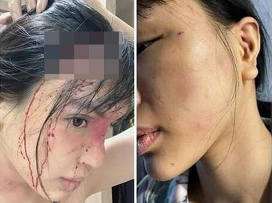 tin tuc phap luat ngay 4 12 cong an lam ro vu sieu mau kha trang to bi ban trai hanh hung dspl 1