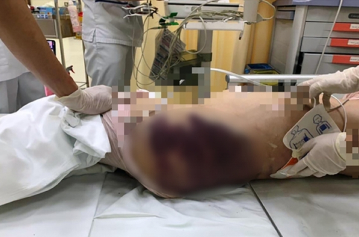vu be gai 8 tuoi bi di ghe bao hanh ban quan ly chung cu saigon pearl noi gi dspl 2 vu be gai 8 tuoi bi di ghe bao hanh ban quan ly chung cu saigon pearl noi gi dspl 2