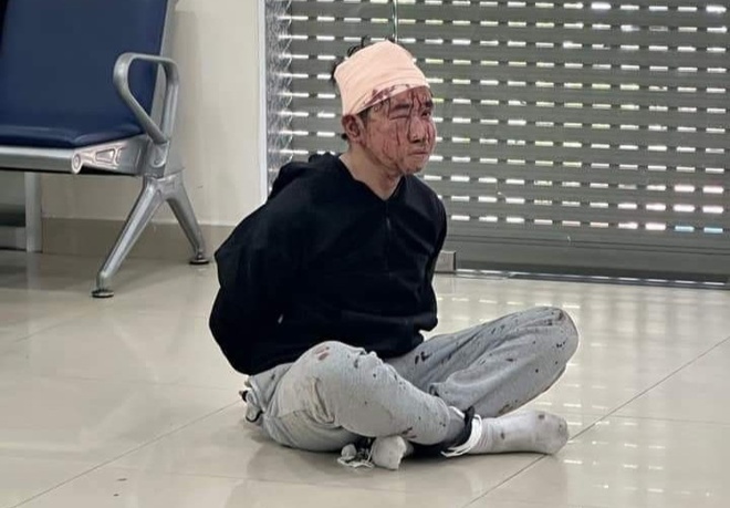 vu cuop ngan hang sacombank o binh duong thong tin moi nhat dspl 2