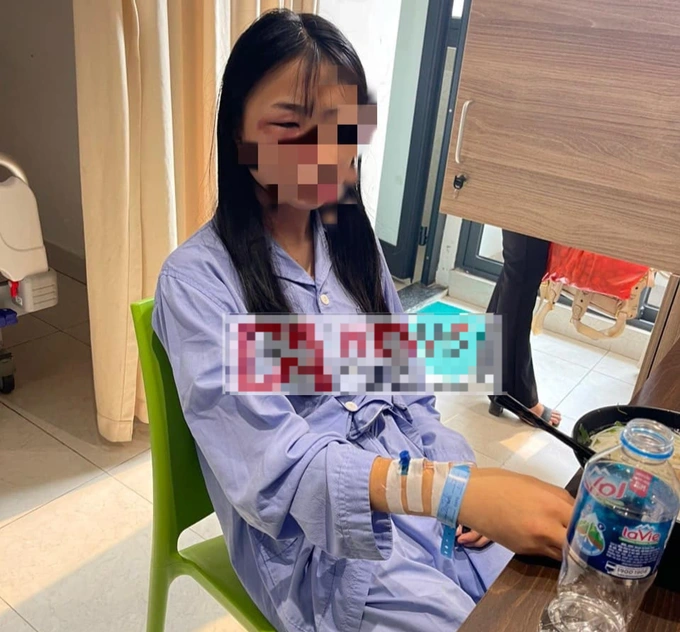 vu nu sinh lop 8 bi danh hoi dong den nhap vien cong an vao cuoc dieu tra dspl 1 vu nu sinh lop 8 bi danh hoi dong den nhap vien cong an vao cuoc dieu tra dspl 1