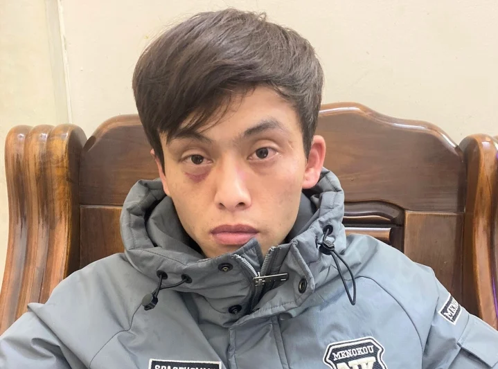 vu be 2 thang tuoi bi bao hanh o lam dong nghi pham da dung bang keo dan quanh mieng nan nhan dspl 1 vu be 2 thang tuoi bi bao hanh o lam dong nghi pham da dung bang keo dan quanh mieng nan nhan dspl 1
