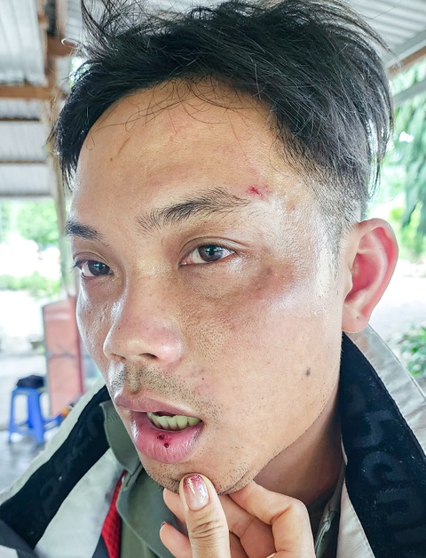 lam ro thong tin nam du khach bi bi danh o nha trang dspl 2 lam ro thong tin nam du khach bi bi danh o nha trang dspl 2