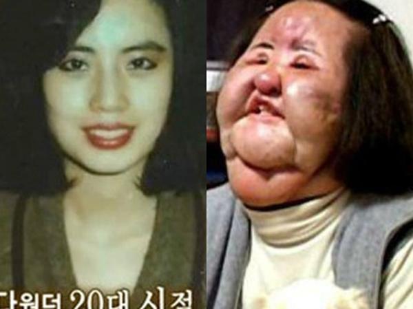 nhung ca phau thuat tham my that bai cua showbiz tu noi tieng den bieu tuong tham hoa dspl 7 nhung ca phau thuat tham my that bai cua showbiz tu noi tieng den bieu tuong tham hoa dspl 7