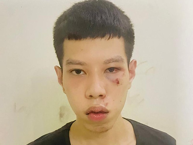bat giu doi tuong cuop 16 trieu dong tien luong huu cua cu ba 70 tuoi bat giu doi tuong cuop 16 trieu dong tien luong huu cua cu ba 70 tuoi