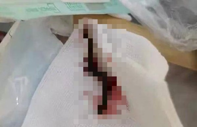 co gai vat va vi dau tai bac si kiem tra lien phat hien thu ron nguoi ben trong