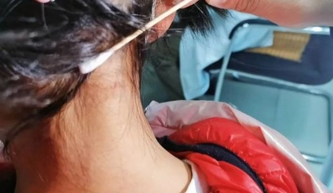 gay con gai xuat hien dom den me tuong not ruoi moi moc nghe bac si noi lien so tai mat gay con gai xuat hien dom den me tuong not ruoi moi moc nghe bac si noi lien so tai mat